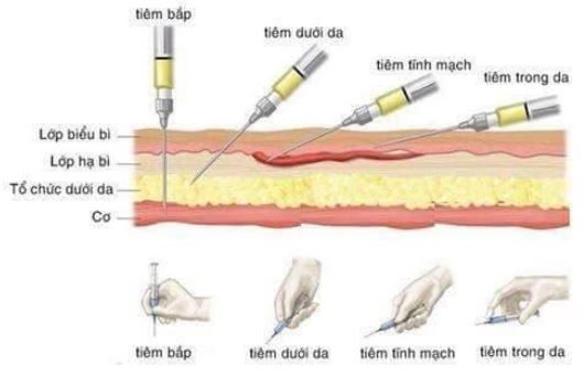 Hướng dẫn sử dụng tiêm dưới da